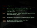 Mushroom Video~ The Hunt for Wild Magic Mushrooms 3 of 4
Mushroom Video~ The Hunt for Wild Magic Mushrooms 3 of 4